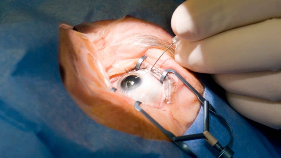 3 דברים שכדאי לבדוק לפני שקובעים ניתוח עיניים